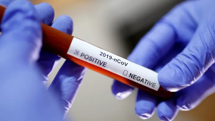 Coronavirus-COVID-19